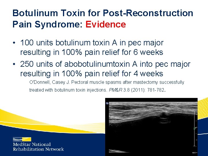 Botulinum Toxin for Post-Reconstruction Pain Syndrome: Evidence • 100 units botulinum toxin A in