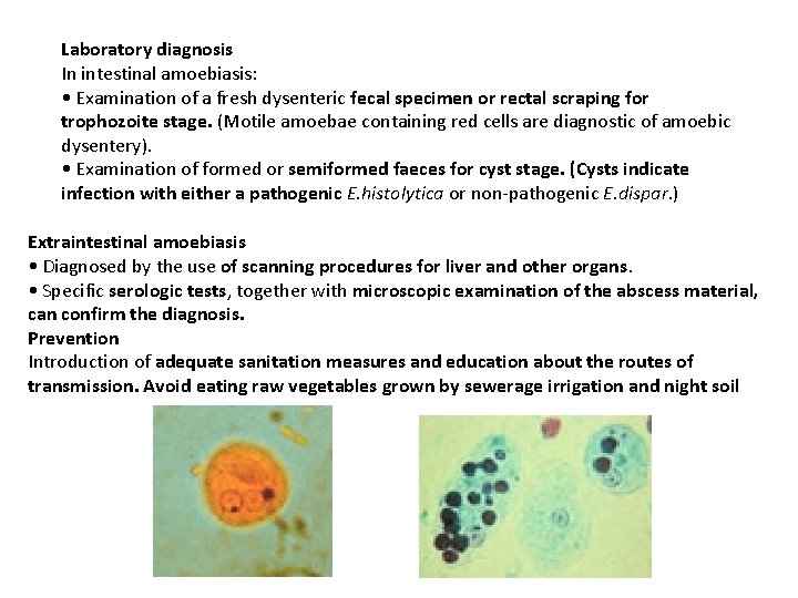 Laboratory diagnosis In intestinal amoebiasis: • Examination of a fresh dysenteric fecal specimen or