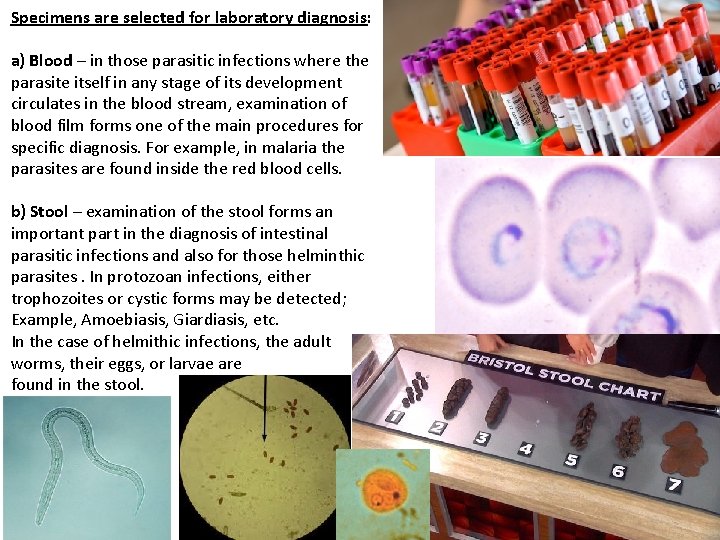 Specimens are selected for laboratory diagnosis: a) Blood – in those parasitic infections where