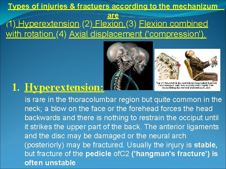 Types of injuries & fractuers according to the mechanizum are (1) Hyperextension. (2) Flexion.