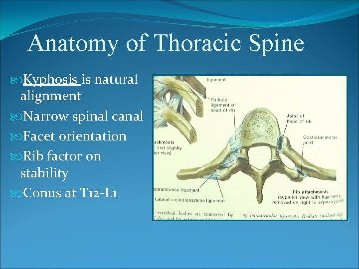 Anatomy of Thoracic Spine Kyphosis is natural alignment Narrow spinal canal Facet orientation Rib