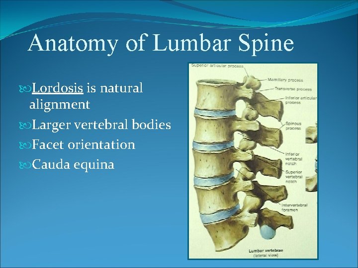 Anatomy of Lumbar Spine Lordosis is natural alignment Larger vertebral bodies Facet orientation Cauda