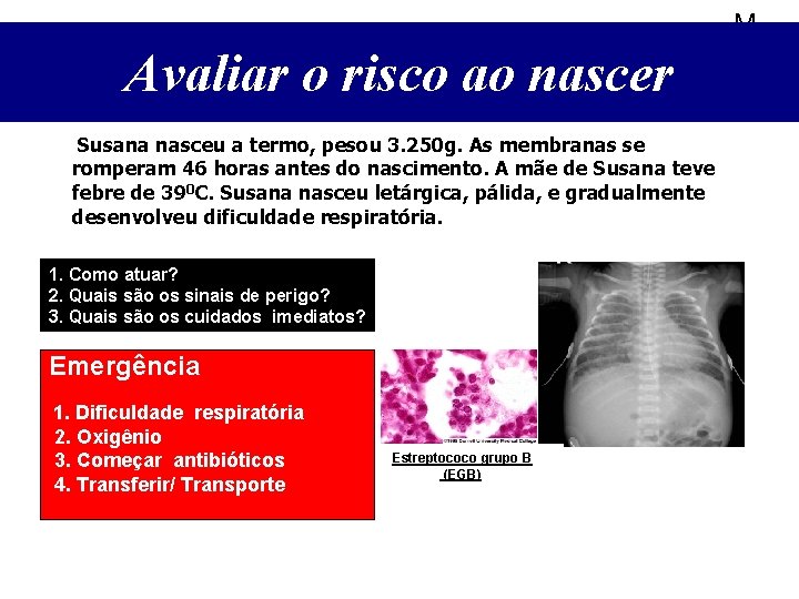 M Avaliar o risco ao nascer Susana nasceu a termo, pesou 3. 250 g.