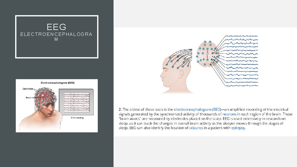 EEG ELECTROENCEPHALOGRA M 