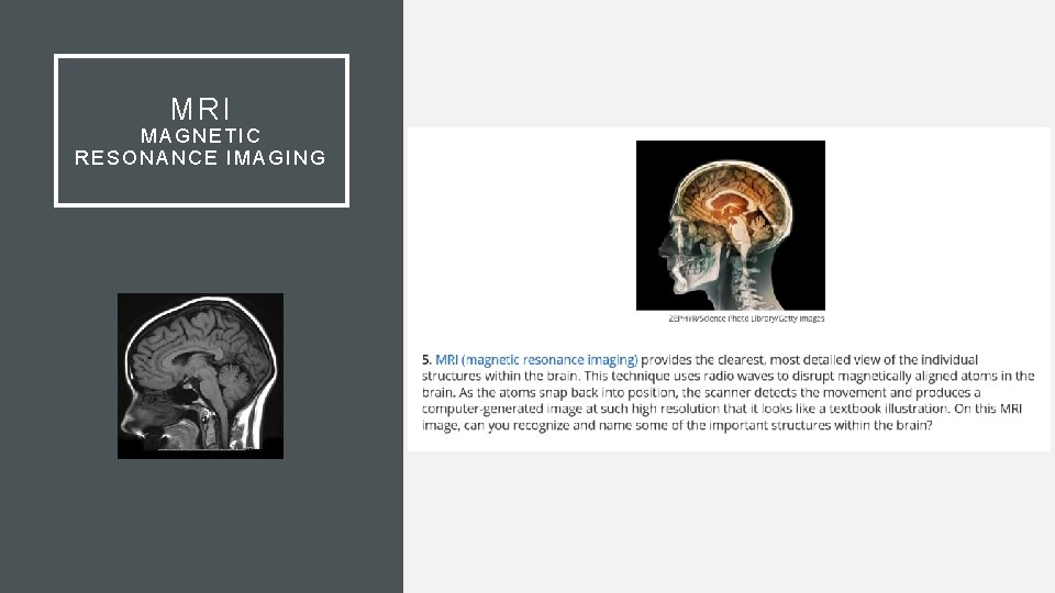 MRI MAGNETIC RESONANCE IMAGING 