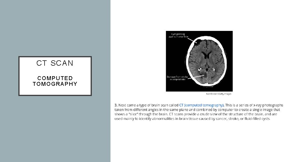 CT SCAN COMPUTED TOMOGRAPHY 