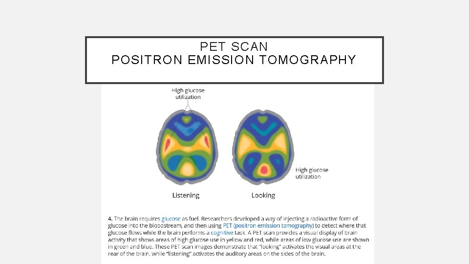 PET SCAN POSITRON EMISSION TOMOGRAPHY 