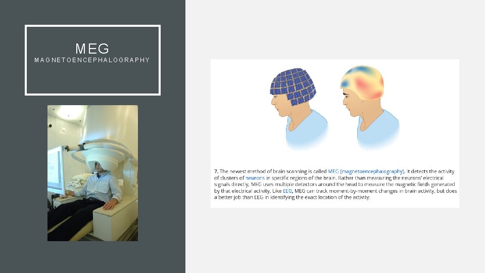 MEG MAGNETOENCEPHALOGRAPHY 
