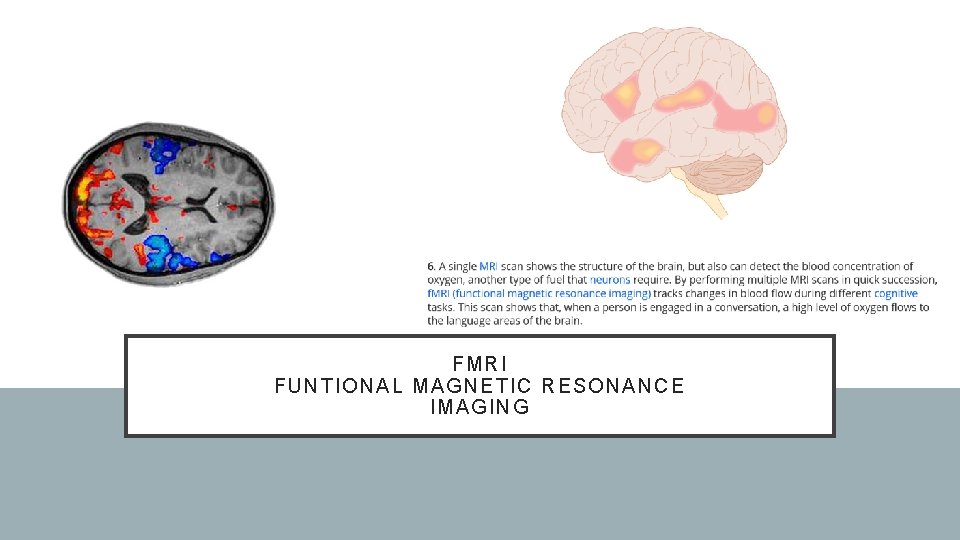 FM RI FUNTIONAL M AG NE TI C RESO NANCE I MA GI NG