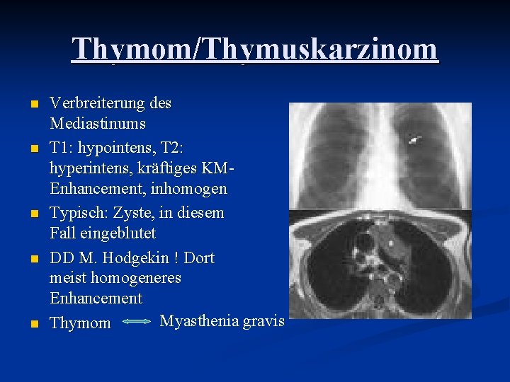 Thymom/Thymuskarzinom n n n Verbreiterung des Mediastinums T 1: hypointens, T 2: hyperintens, kräftiges