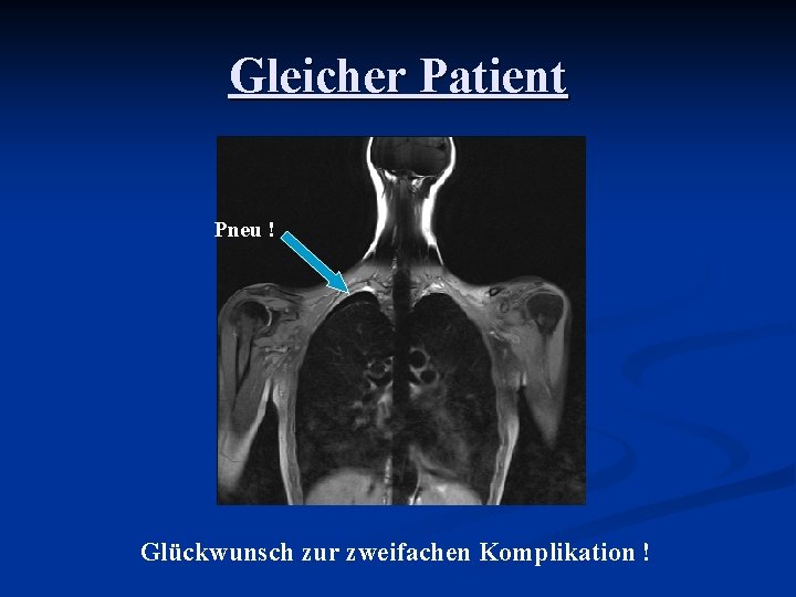 Gleicher Patient Pneu ! Glückwunsch zur zweifachen Komplikation ! 