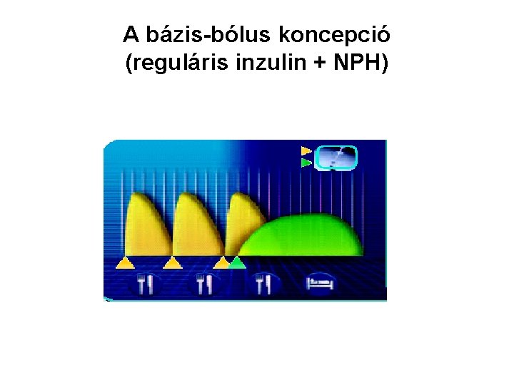 A bázis-bólus koncepció (reguláris inzulin + NPH) 