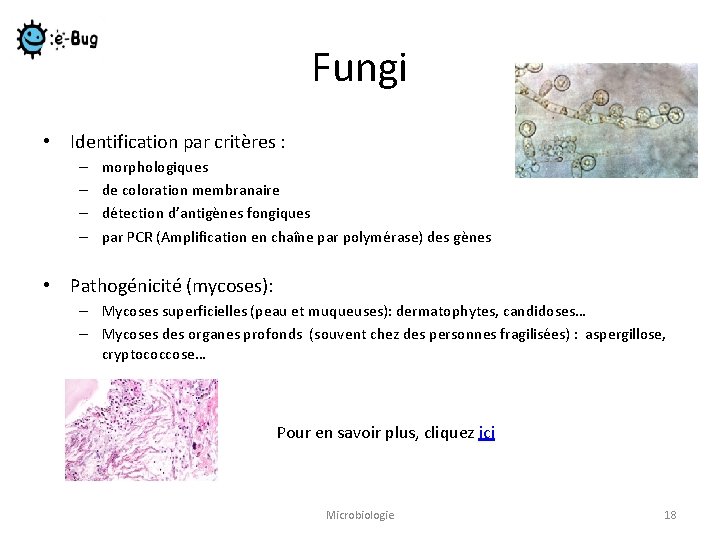 Fungi • Identification par critères : – – morphologiques de coloration membranaire détection d’antigènes