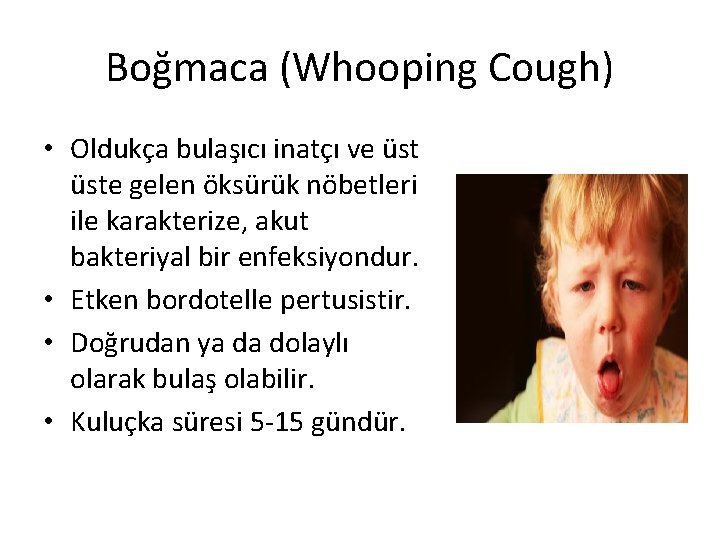 Boğmaca (Whooping Cough) • Oldukça bulaşıcı inatçı ve üste gelen öksürük nöbetleri ile karakterize,