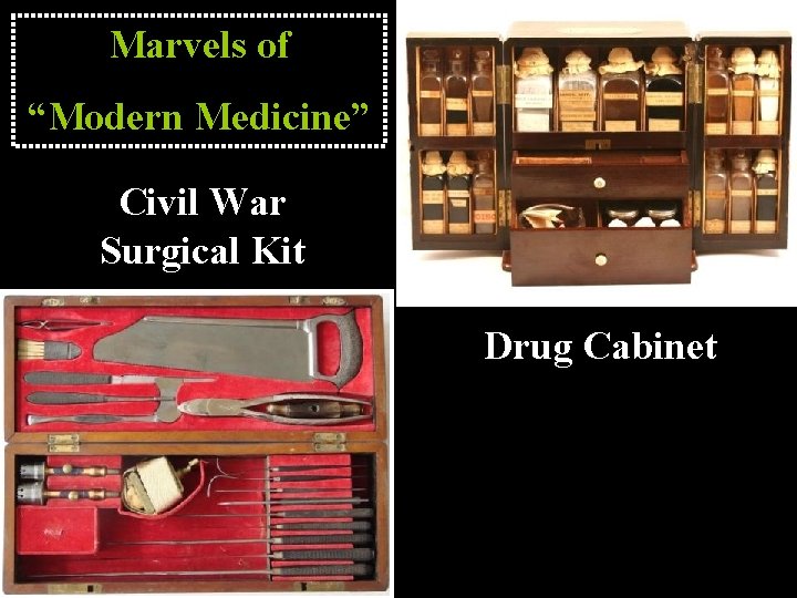 Marvels of “Modern Medicine” Civil War Surgical Kit Drug Cabinet 