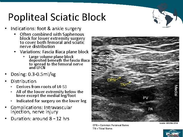 Popliteal Sciatic Block • Indications: foot & ankle surgery • Often combined with Saphenous
