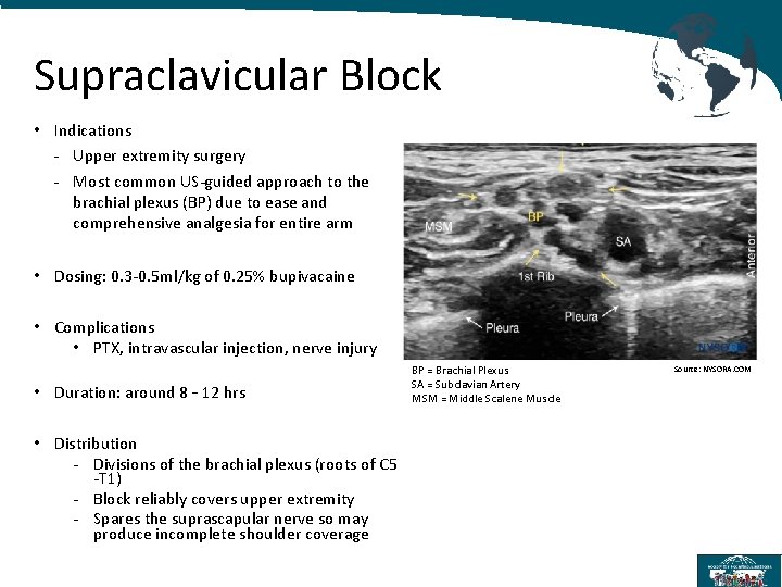 Supraclavicular Block • Indications - Upper extremity surgery - Most common US-guided approach to