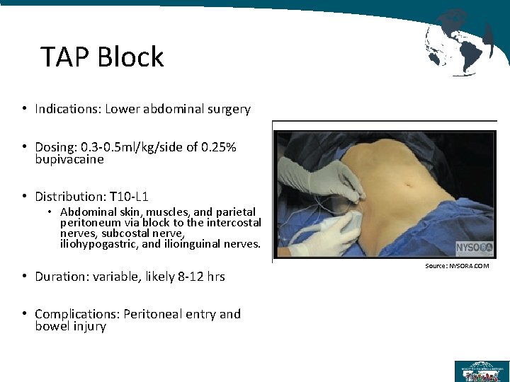 TAP Block • Indications: Lower abdominal surgery • Dosing: 0. 3 -0. 5 ml/kg/side