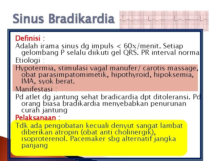 Sinus Bradikardia Definisi : Adalah irama sinus dg impuls < 60 x/menit. Setiap gelombang