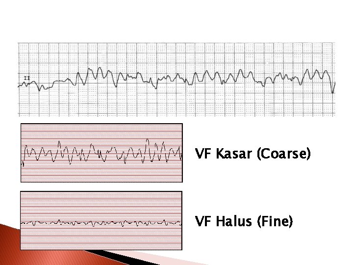 VF Kasar (Coarse) VF Halus (Fine) 