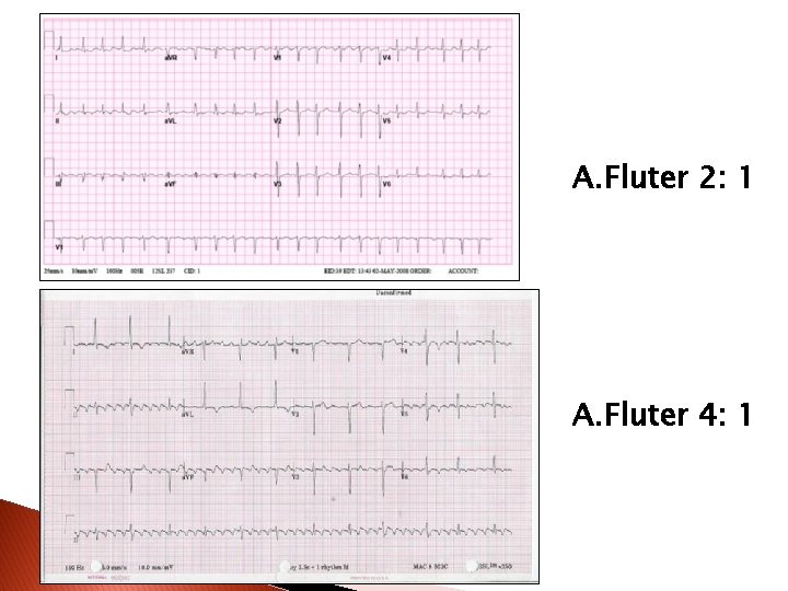 A. Fluter 2: 1 A. Fluter 4: 1 