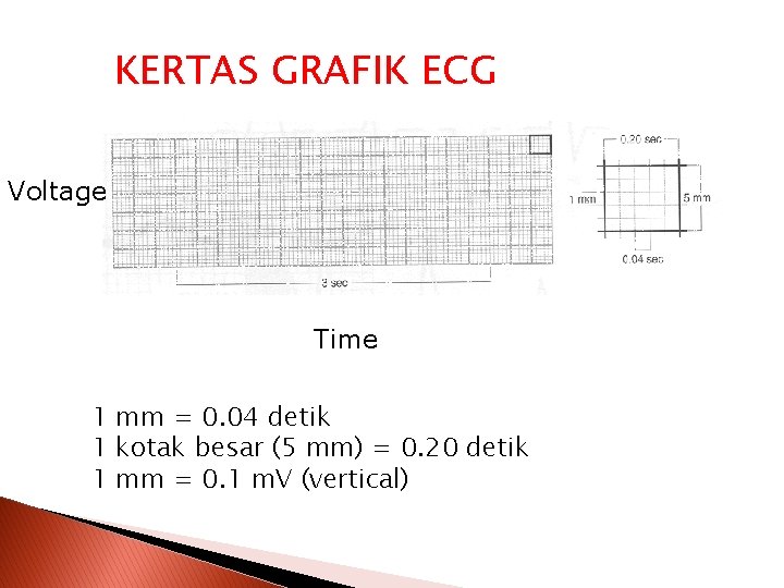 KERTAS GRAFIK ECG Voltage Time 1 mm = 0. 04 detik 1 kotak besar