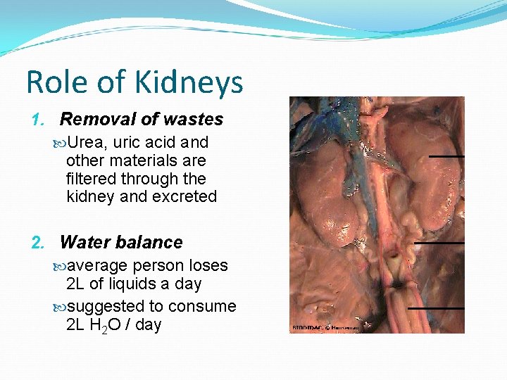 Role of Kidneys 1. Removal of wastes Urea, uric acid and other materials are