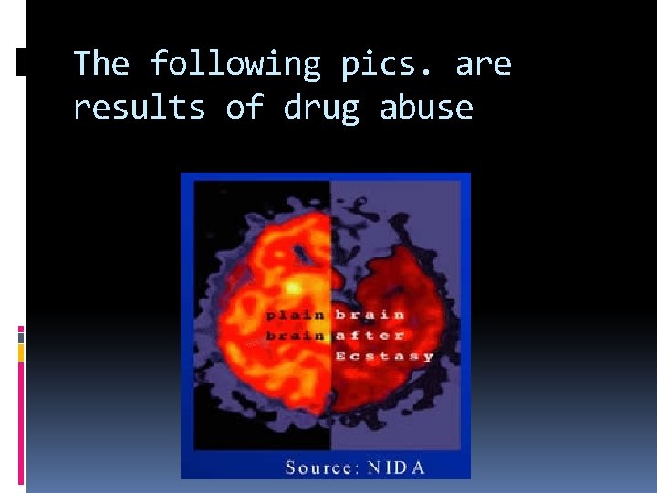 The following pics. are results of drug abuse 