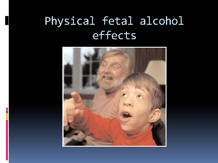 Physical fetal alcohol effects 