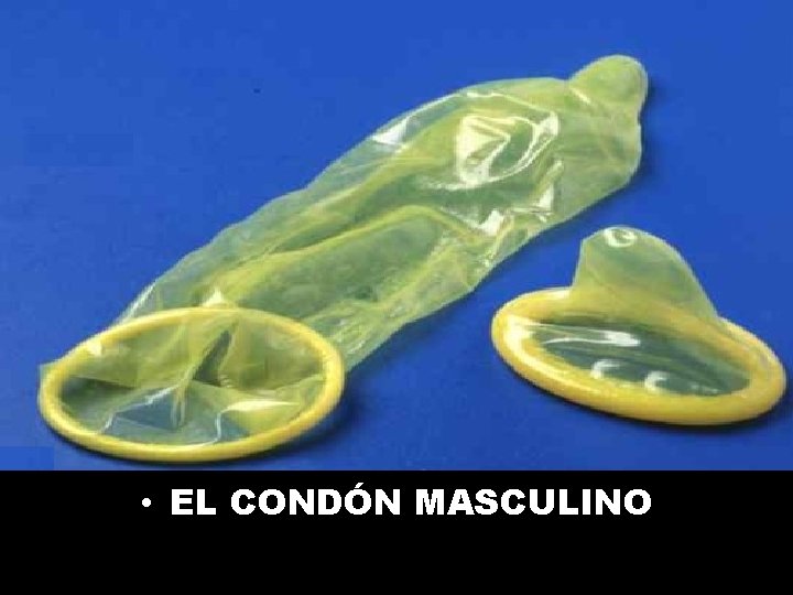  • EL CONDÓN MASCULINO 