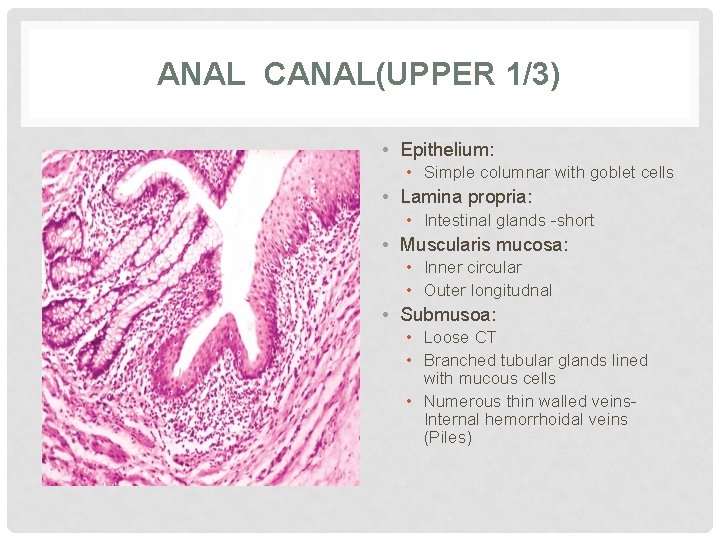 ANAL CANAL(UPPER 1/3) • Epithelium: • Simple columnar with goblet cells • Lamina propria: