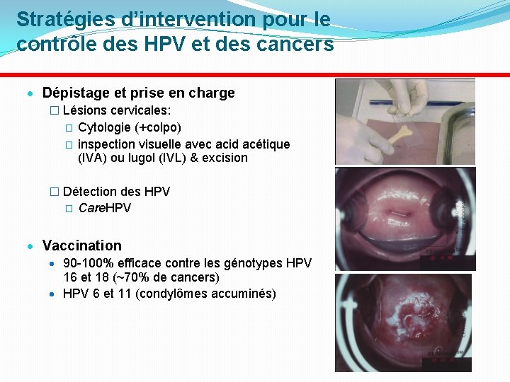 Stratégies d’intervention pour le contrôle des HPV et des cancers · Dépistage et prise