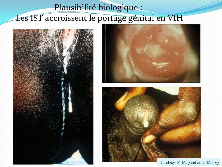 Plausibilité biologique : Les IST accroissent le portage génital en VIH Courtesy: P. Mayaud