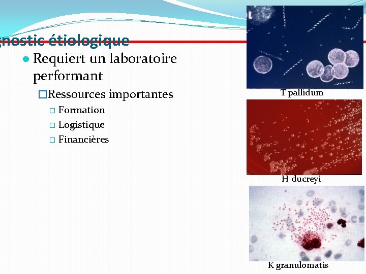 gnostic étiologique ● Requiert un laboratoire performant �Ressources importantes � Formation � Logistique �