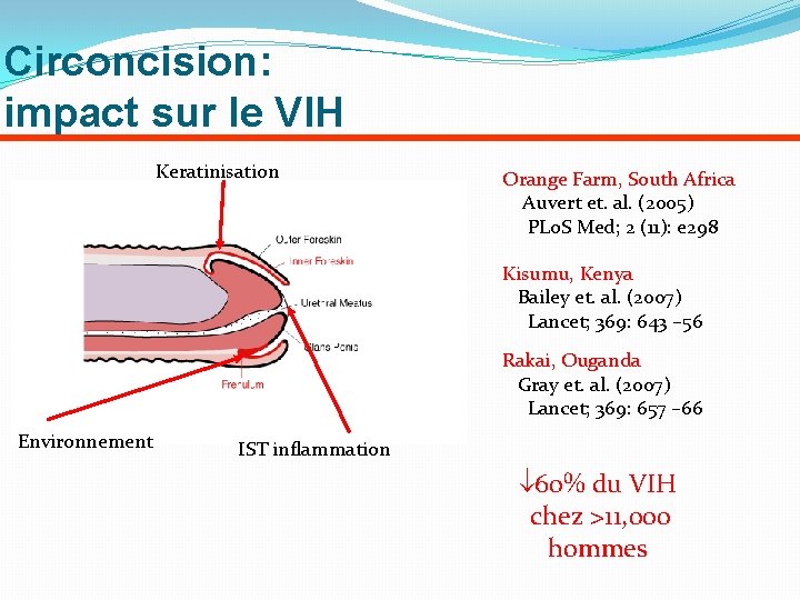 Circoncision: impact sur le VIH Keratinisation Orange Farm, South Africa Auvert et. al. (2005)