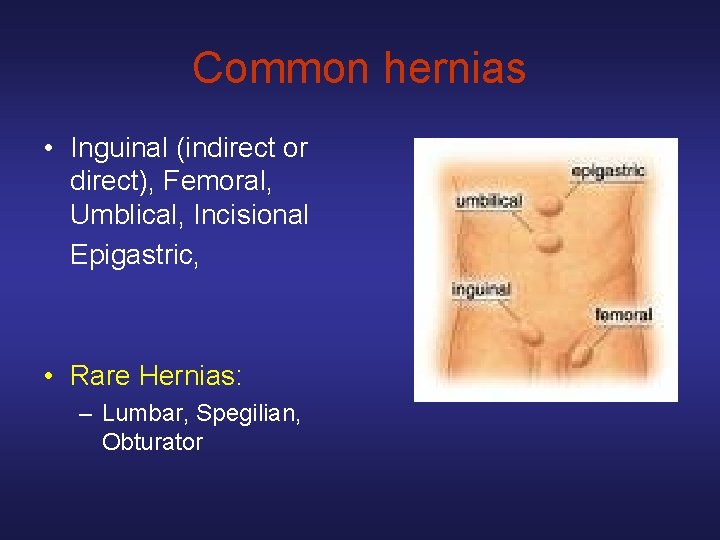 Common hernias • Inguinal (indirect or direct), Femoral, Umblical, Incisional Epigastric, • Rare Hernias: