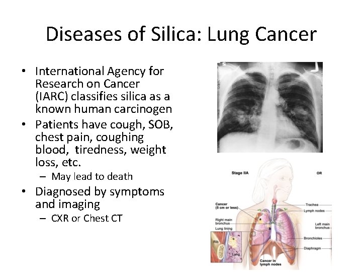 Diseases of Silica: Lung Cancer • International Agency for Research on Cancer (IARC) classifies Diseases of Silica: Lung Cancer • International Agency for Research on Cancer (IARC) classifies