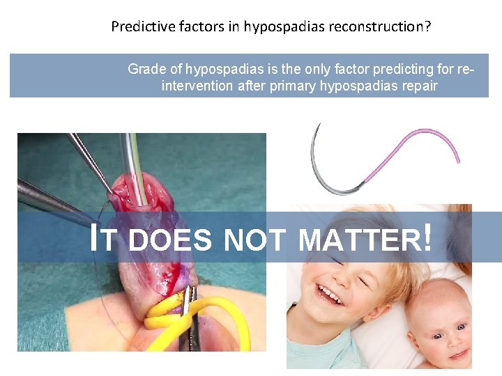 Predictive factors in hypospadias reconstruction? Grade of hypospadias is the only factor predicting for