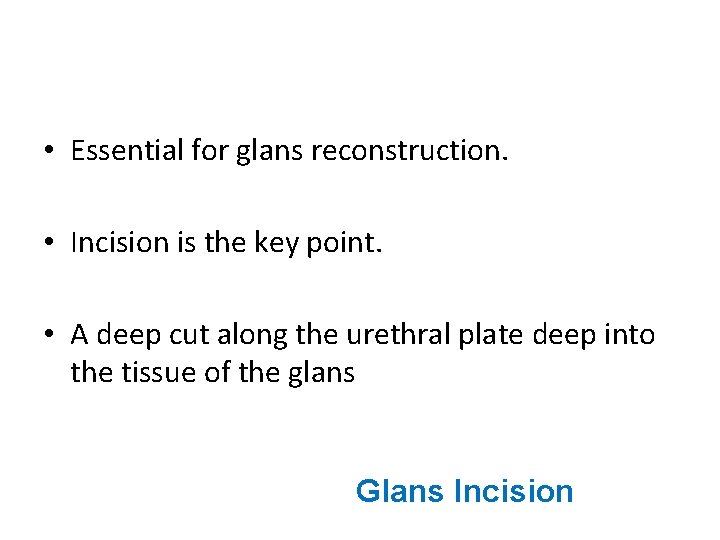  • Essential for glans reconstruction. • Incision is the key point. • A