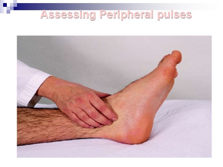 Assessing Peripheral pulses 