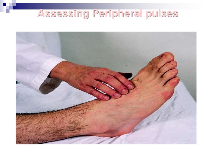 Assessing Peripheral pulses 