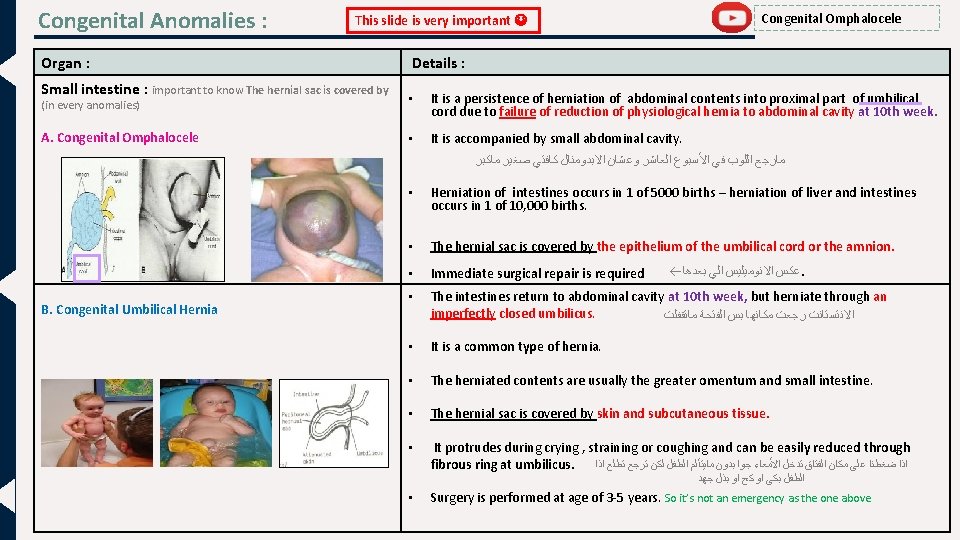 Congenital Anomalies : Organ : Small intestine : important to know The hernial sac