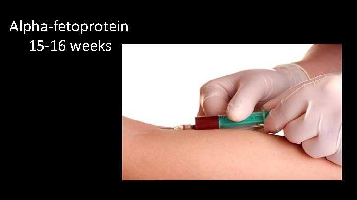 Alpha-fetoprotein 15 -16 weeks 