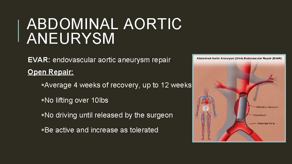 ABDOMINAL AORTIC ANEURYSM EVAR: endovascular aortic aneurysm repair Open Repair: §Average 4 weeks of