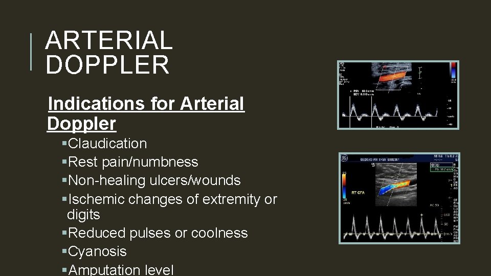 ARTERIAL DOPPLER Indications for Arterial Doppler §Claudication §Rest pain/numbness §Non-healing ulcers/wounds §Ischemic changes of