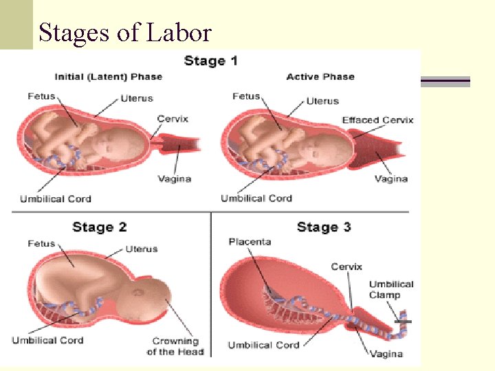 Stages of Labor n First Stage n n n Latent phase Active phase Transition