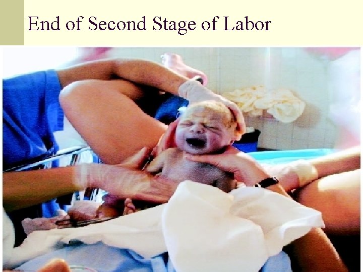 End of Second Stage of Labor n Second stage Period from full dilatation and