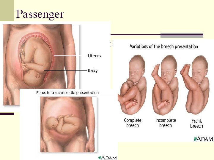 Passenger n Types of fetal presentation n Cephalic Breech Shoulder 