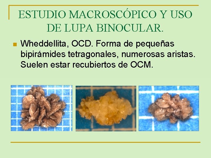ESTUDIO MACROSCÓPICO Y USO DE LUPA BINOCULAR. n Wheddellita, OCD. Forma de pequeñas bipirámides