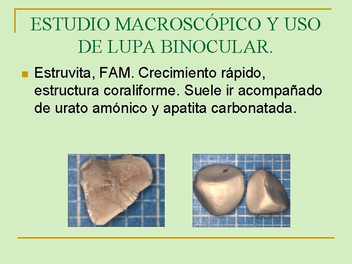 ESTUDIO MACROSCÓPICO Y USO DE LUPA BINOCULAR. n Estruvita, FAM. Crecimiento rápido, estructura coraliforme.